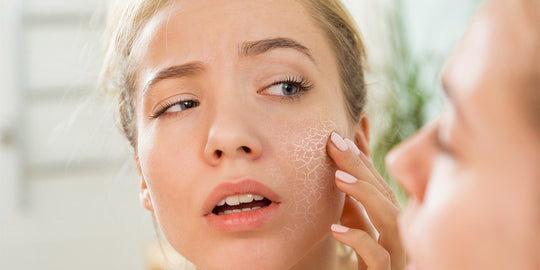7  DIY Dry-Skin Remedies That You Can Easily Make At Home