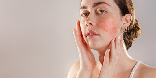 Sensitive Skin Care Causes And Treatments