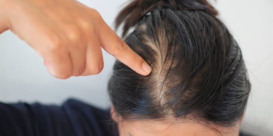 4 Lesser Known Causes Of Hair Thinning