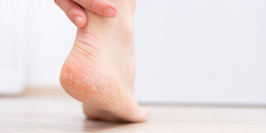 Dry, Cracked Feet No More! Essential Foot Care Tips You Need To Know This Winter